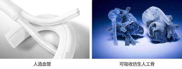 人造血管