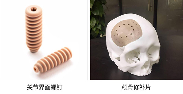 关节界面螺钉
